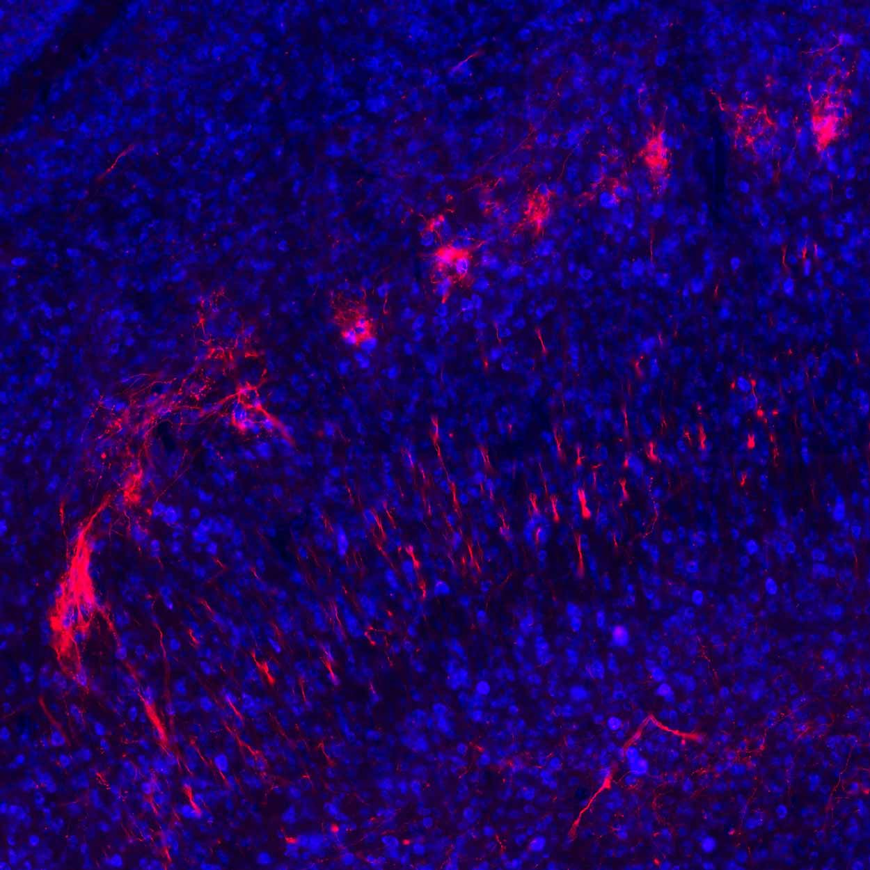 Shown in red are branched from cells in the substantia nigra brain region that connect to the superior colliculus region