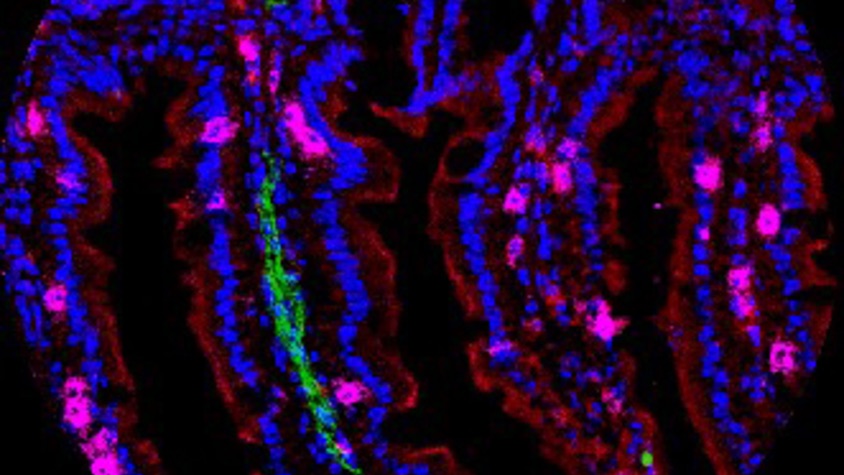 Immune cells in tissues offering unique defenses against pathogens and cancers