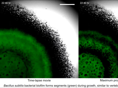 bacterial segmentation