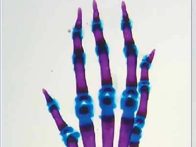 skeletal hand