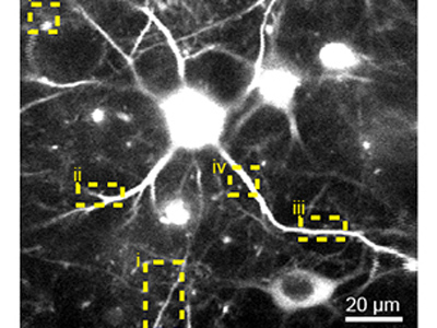 Microscopic image of cell calcium