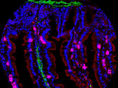 Immune Cells Anchored in Tissues Offer Unique Defenses Against Pathogens and Cancers