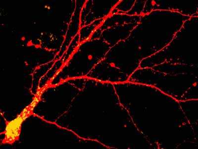 biosights: August 7 2017 - Synaptic activity shifts dendritic lysosomes