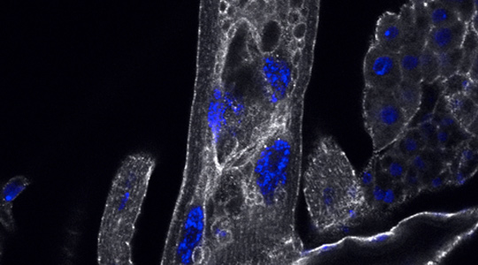 2 of 4, How cells maintain subcellular organization is key to understanding and treating myopathy and neuropathy